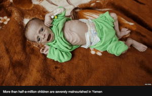Reuters photo from BBC article on the current Yemen humanitarian crisis.